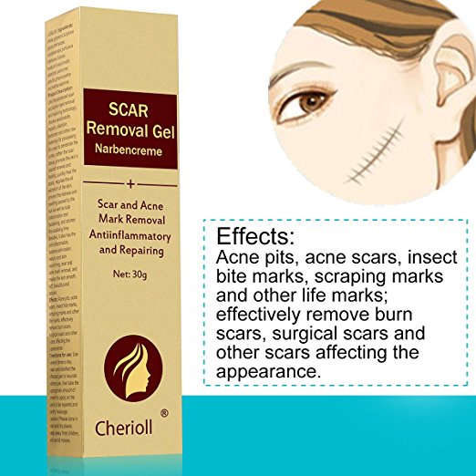 Cherioll Scar Removal Gel