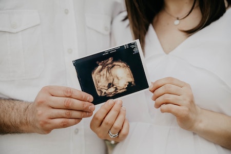 Couple holding ultrasound picture of baby - prenatal vitamins to help get pregnant