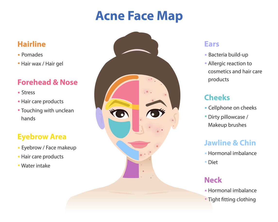 skin mapping - graphic